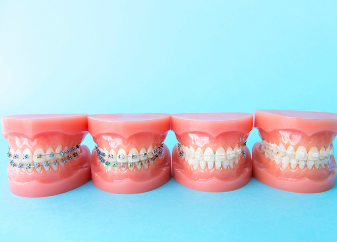 すみれデンタルクリニック_計画的に歯を動かしやすく、幅広い症例に対応可能なワイヤー矯正に注力