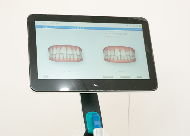 くらもち歯科医院_患者さまへのご負担に配慮し、光学スキャナーを導入。治療過程のシミュレーションも可能です