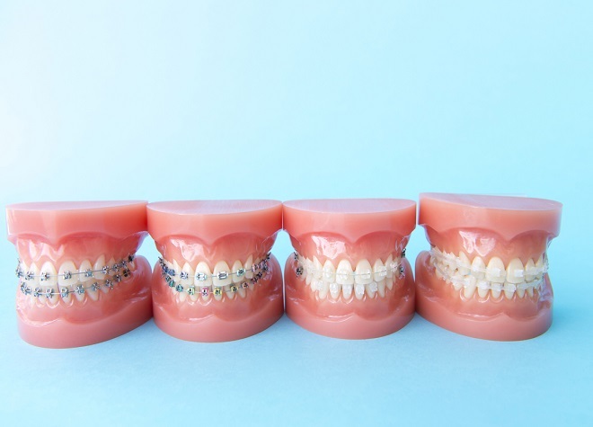 ラウレア歯科矯正歯科クリニック_こまめに歯並びの変化をご確認いただき、矯正治療に対するモチベーションを維持できるよう配慮