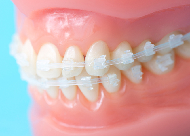 こころ歯科クリニック_矯正治療の詳細を事前に詳しくお伝えし、ご納得いただける結果へと導きます