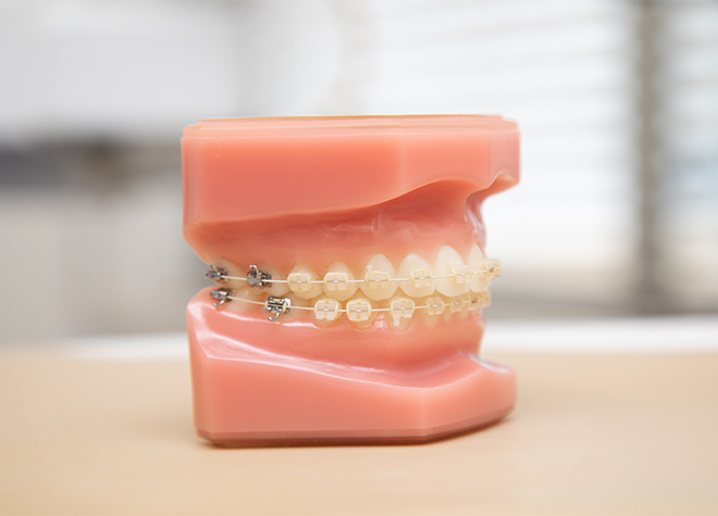 みやはら歯科医院_矯正治療中と治療後もお口のメンテナンスをサポートすることが可能