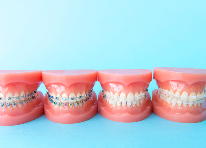 吉塚ＳＥＴ歯科_複数の選択肢からご希望に近い矯正治療プランをご提案いたします