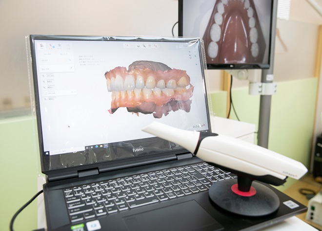 かすやま歯科クリニック_精密検査