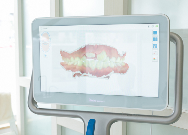 へんみ歯科医院_治療後の歯並びをシミュレーションして、患者様のモチベーションにつなげる工夫
