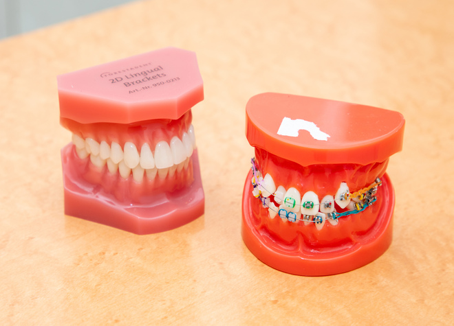 谷山歯科医院_装置ごとのメリットとデメリットをお伝えし、患者様の症状やご要望に合う治療方法をご提案