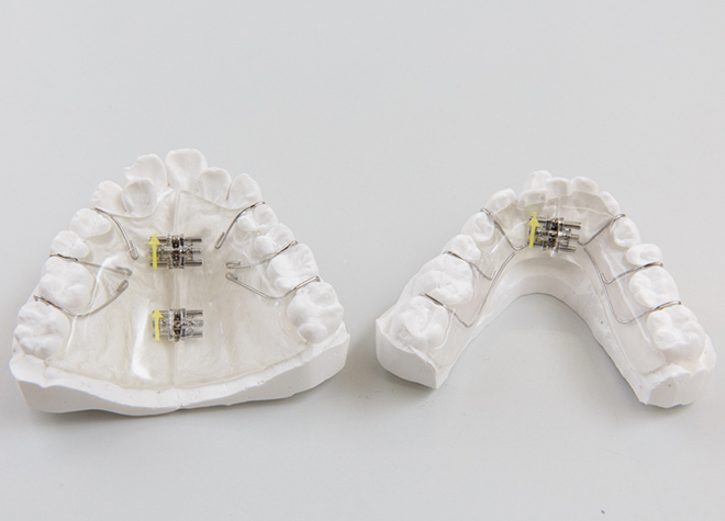 まつもと歯科医院_それぞれのお子様に合わせた装置で、虫歯にも配慮しながら歯並びや噛み合わせの改善を目指す