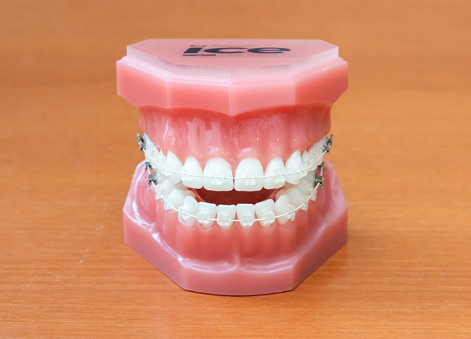 医療法人社団 博伸会　いぬかい医大モール歯科クリニック_透明なブラケットを用いて、虫歯にならないよう配慮しながら治療を進めていきます