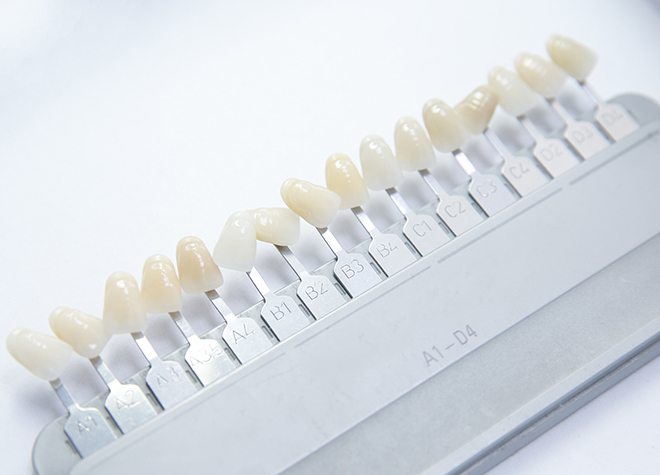 大垣スイトスクエア歯科・矯正歯科_口内のチェック・クリーニングや治療・歯の型取り