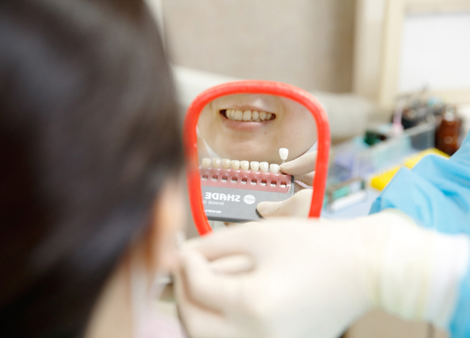 ウェルシティ横須賀歯科診療所_診察・カウンセリング・クリーニング・歯の型取り