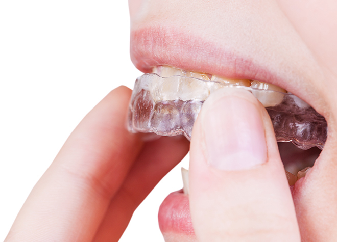 与野グリーン歯科クリニック_まずはクリーニングでしっかりと汚れをオフ。虫歯チェックで歯の健康面にも配慮いたします