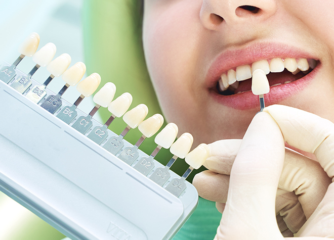 与野グリーン歯科クリニック_カウンセリング・クリーニングや治療・歯の型取り