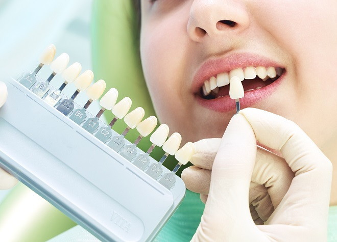 佃歯科室_3種類の施術方法から、患者様お一人おひとりに合わせたホワイトニングをご提案