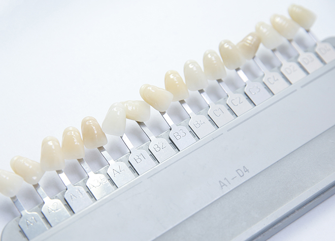 たけお歯科_特徴の異なる3種類のホワイトニング方法に対応。ご希望に合わせてお選びいただけます