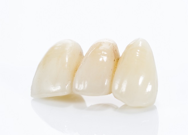 もみの木歯科_患者さまが目指したい白さに近づけられるよう、ホワイトニング前のお口チェックや検査に注力