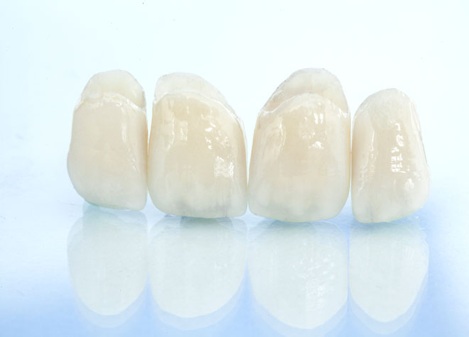 あべひろ総合歯科_ホワイトニング後の白さやお口の健康をサポートするため、定期的なクリーニングにも対応