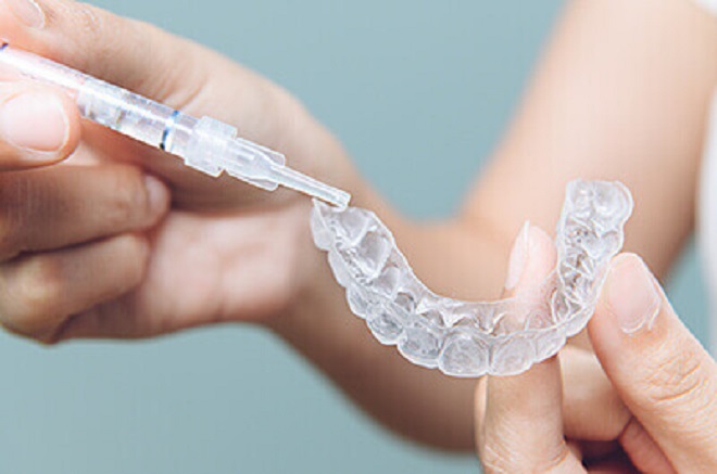 柏 なかよし歯科・口腔外科_ほかの治療と組み合わせてより美しい口元を目指せる。幅広い診療メニューに対応