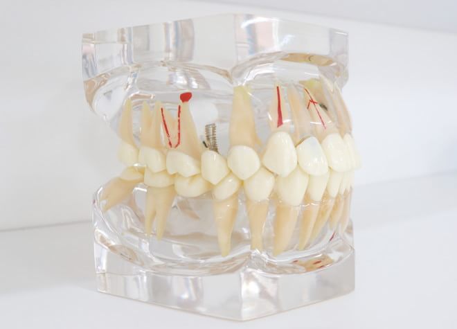 アイデンタルクリニック姫路にある歯の模型